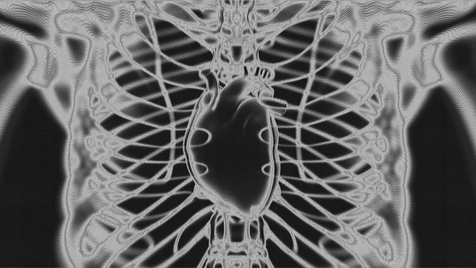 Neural Overdrive